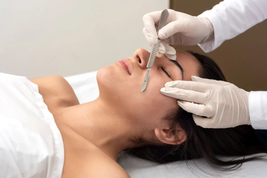 Dermaplaning Newport Beach Orange County