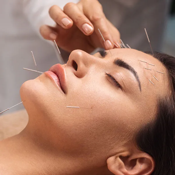 acupuncture doctor newport beach