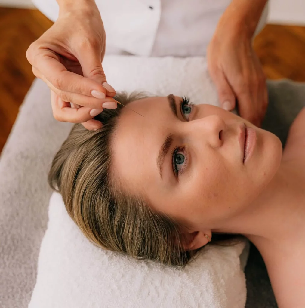 facial acupuncture newport beach orange county