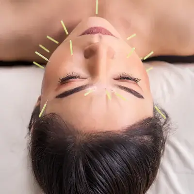 newport beach cosmetic acupuncture facial rejuvenation