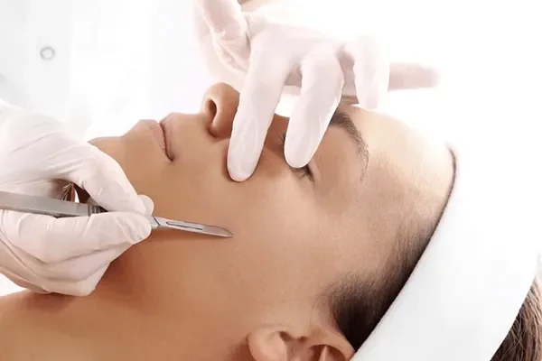 Dermaplaning