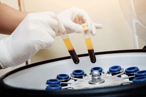 PRP Platelet-rich Plasma Therapy