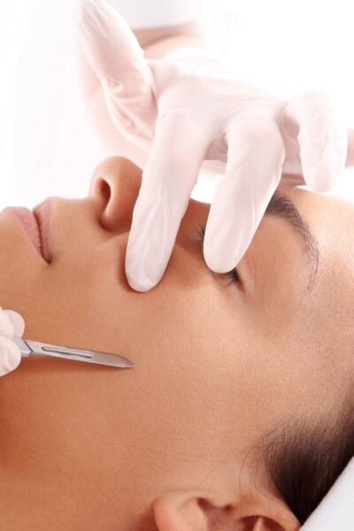 Dermaplaning
