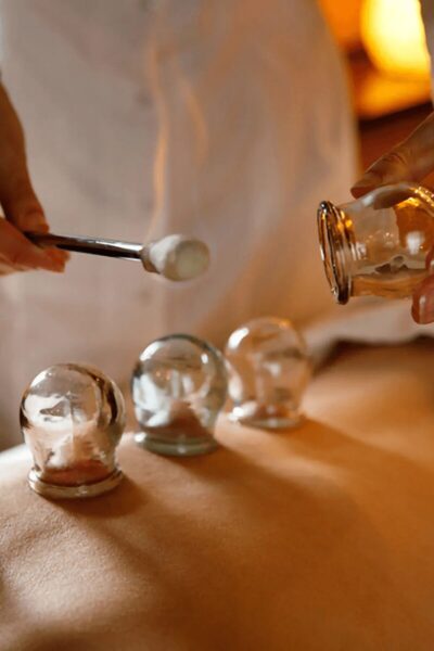 Fire cupping