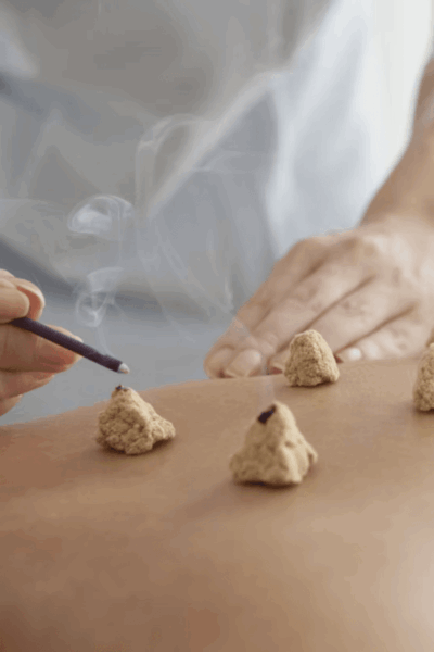 Moxibustion